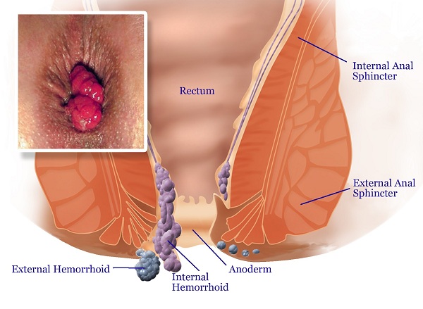 best skin doctors in delhi,psoriasis treatment in delhi,best dermatologist in delhi,best skin specialist in delhi